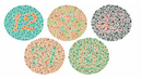 Ishihara 14 Plate Color Test