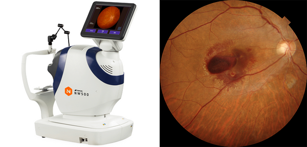 Topcon TRC-NW500 Non-Mydriatic Retinal Camera