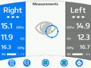 Reichert ORA G-3 Ocular Response Analyzer